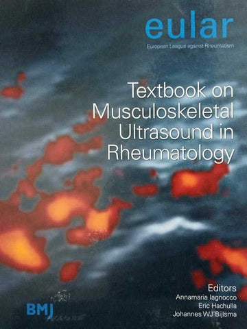 EULAR TEXTBOOK ON MUSCULOSKELETAL ULTRASOUND IN RHEUMATOLOGY