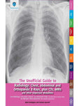 THE UNOFFICIAL GUIDE TO RADIOLOGY: CHEST,ABDOMINAL AND ORTHOPAEDIC X-RAYS, PLUS CTS, MRIs AND OTHER IMPORTANT MODALITIES