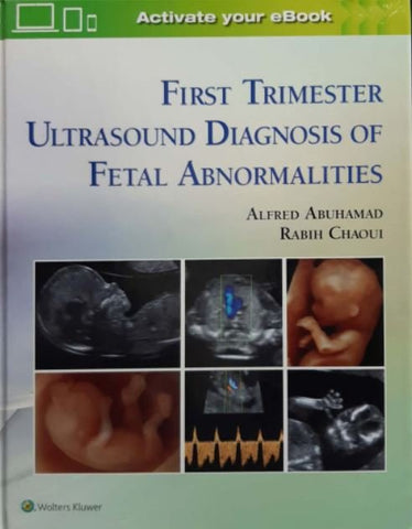 FIRST TRIMESTER ULTRASOUND DIAGNOSIS OF FETAL
