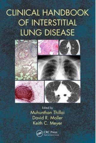 CLINICAL HANDBOOK OF INTERSTITIAL LUNG DISEASE