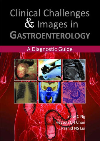 CLINICAL CHALLENGES & IMAGES IN GASTROENTEROLOGY: A DIAGNOSTIC GUIDE