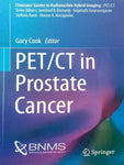 PET/CT IN PROSTATE CANCER