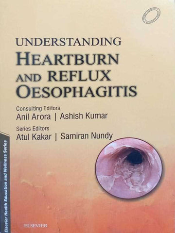 UNDERSTANDING HEARTBURN AND REFLUX OSEOPHAGITS