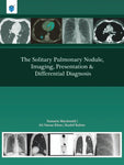 THE SOLITARY PULMONARY NODULE,IMAGING,PRESENTATION & DIFF DIAGNOSIS